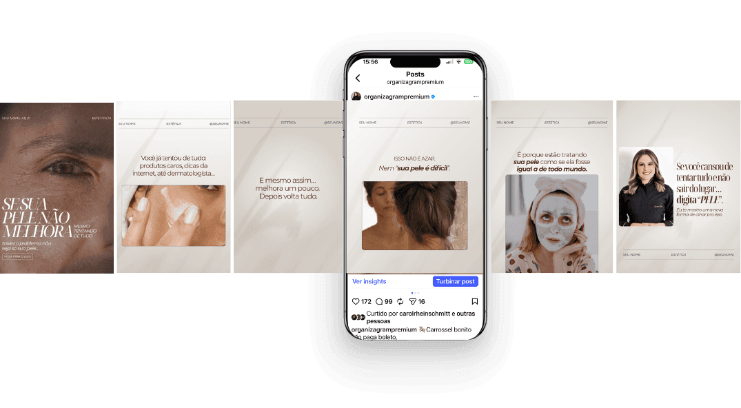 Carrosséis Cortados — Pack Estética