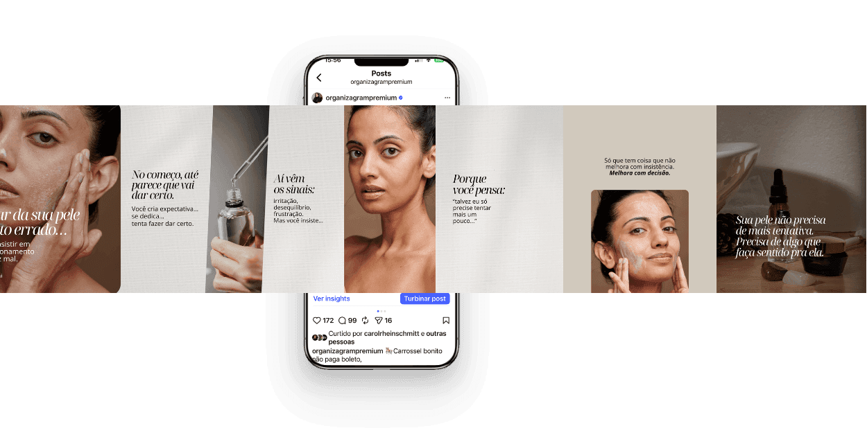 Carrosséis Infinito — Pack Estética